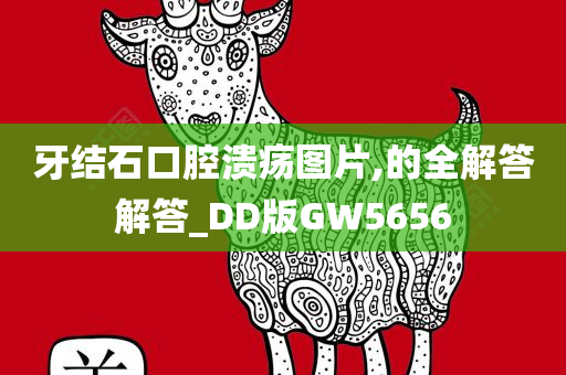 牙结石口腔溃疡图片,的全解答解答_DD版GW5656